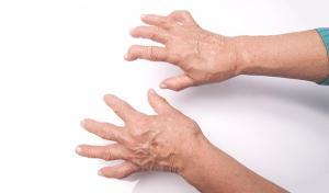 ízületi fájdalom amikor felemeli a kezét artrózis és a lábak kis ízületeinek ízületi gyulladása