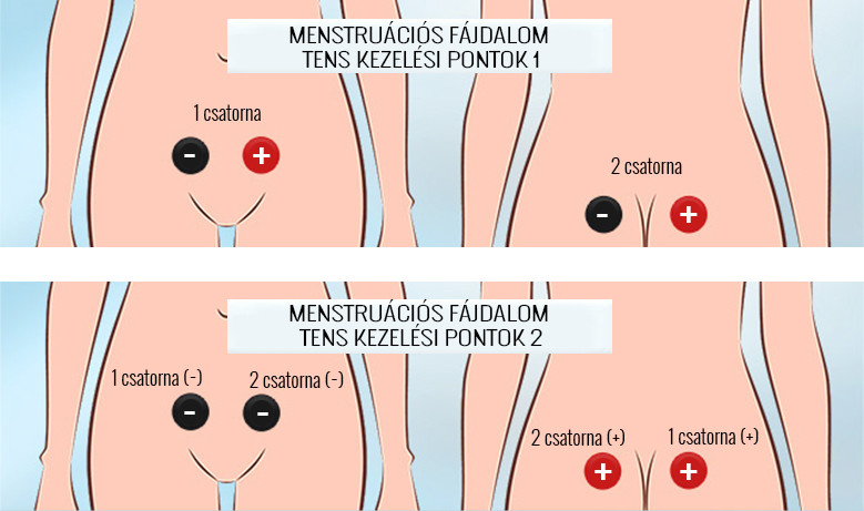 alhasi fájdalom menstruáció alatt Kezelési diagram Prostatitis Vélemények