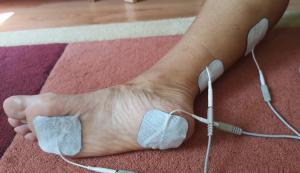 hogyan kell kezelni a duzzadt ízületeket a lábujjakon ízületi betegség esetén milyen kenőcs használható