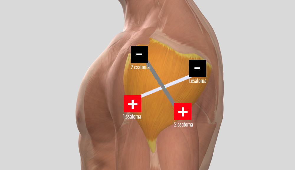 a vállízület periarthritisének otthoni kezelése fájdalom a jobb lapocka közelében a gerinc közelében