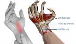 a csípő dysplasztikus artrózisa közös kezelés júniusban