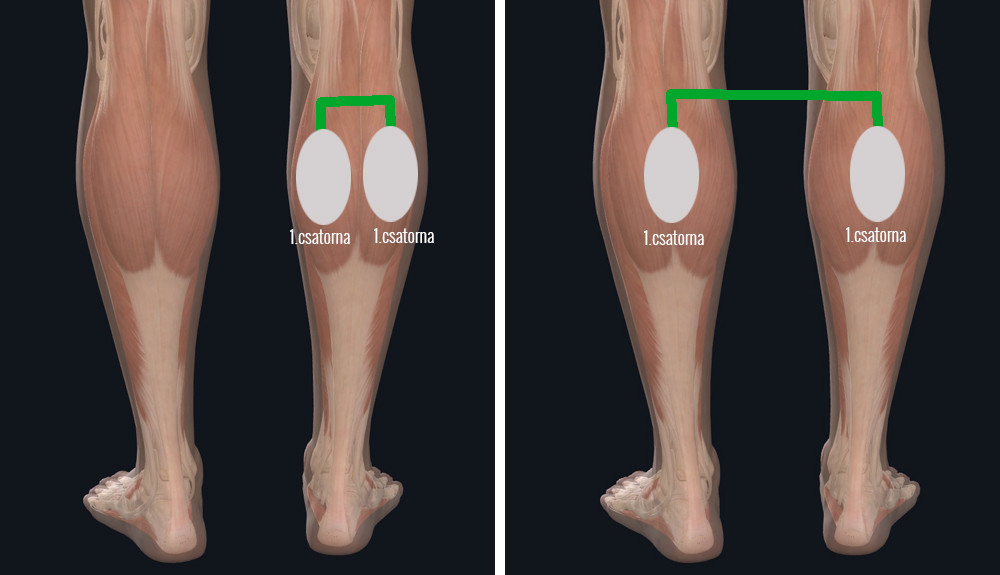 Gyógyítja-e a hirudoterápia a visszérbetegségeket hogy néz ki a visszér a lábakon kezdeti