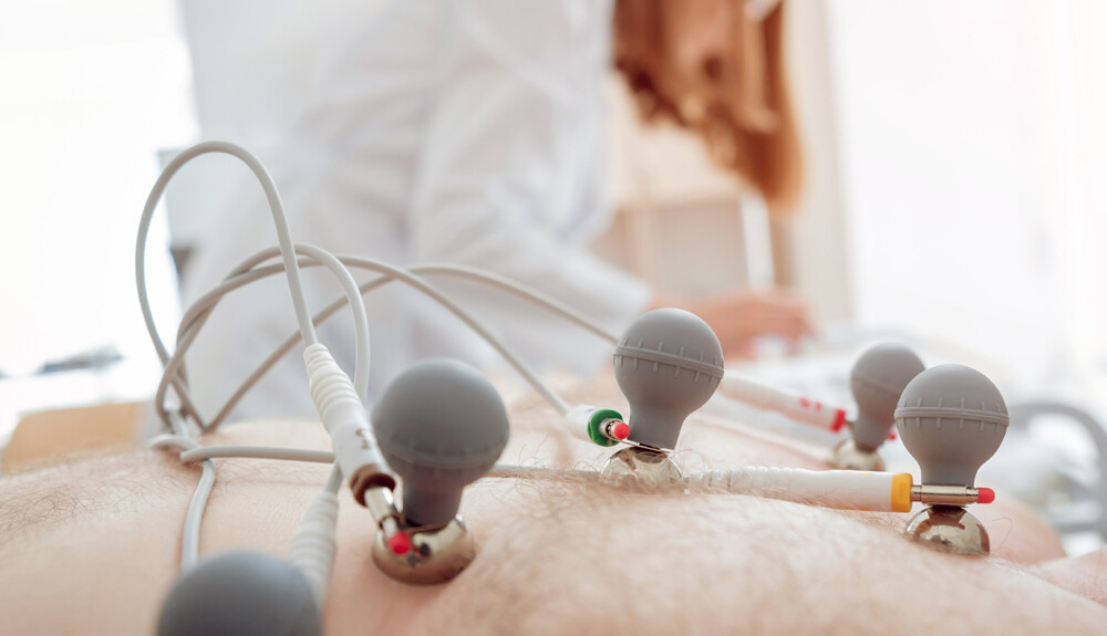 EKG, elektrokardiogram készítése