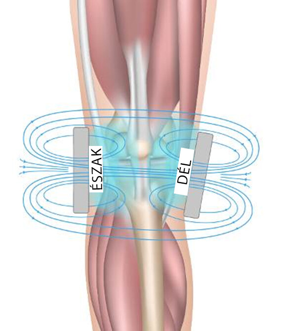 artrózis mágneses kezelése milyen gyógyszer a lábak ízületeinek kezelésére