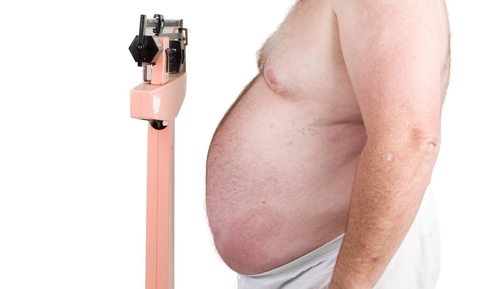 Az elhízás és nyiroködéma kialakulása között szoros az összefüggés